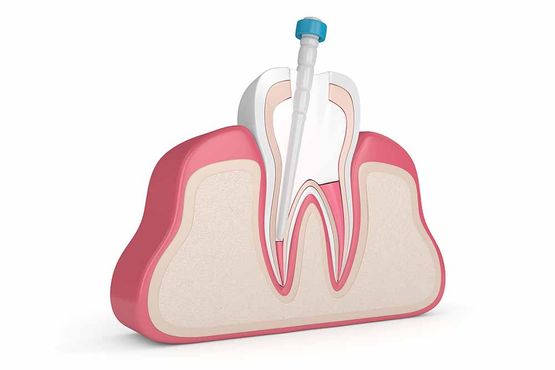 Endodontie